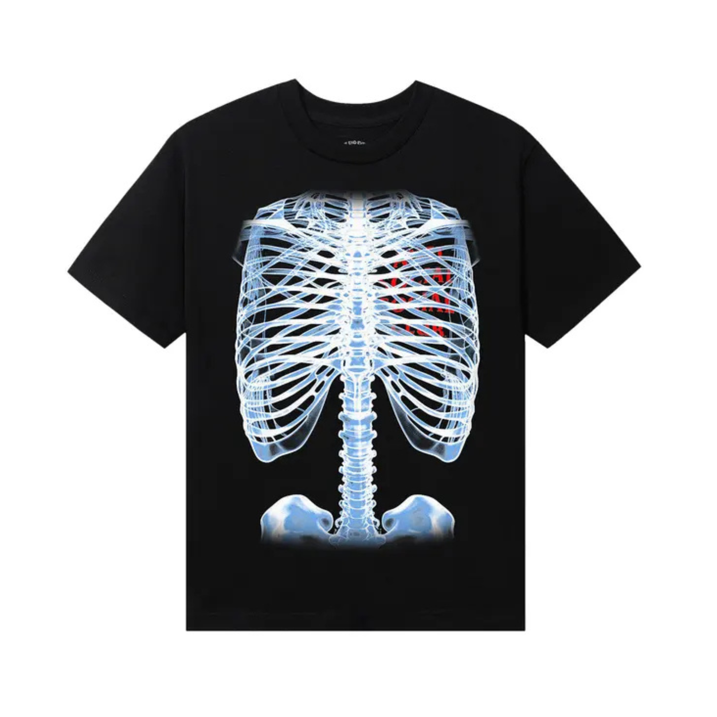 Anti Social Social Club Bones Tee 'Black'