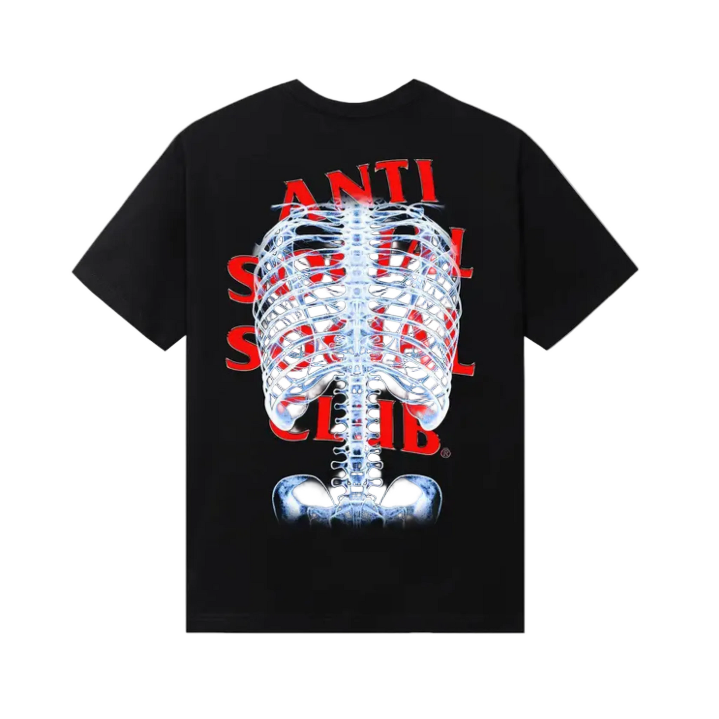 Anti Social Social Club Bones Tee 'Black'